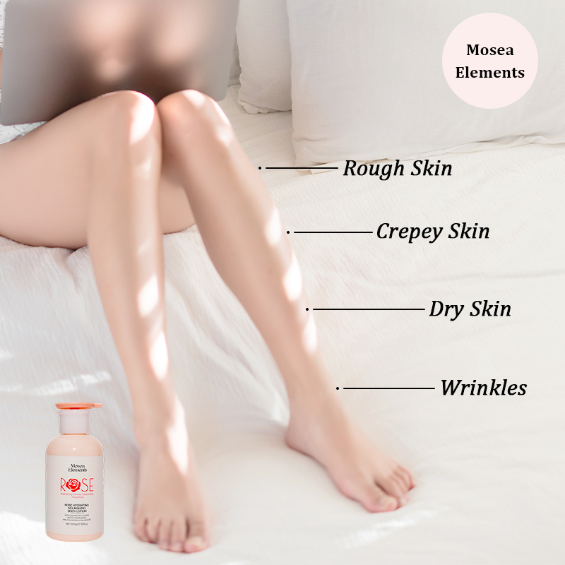 Mosea Elements Rose Blossom Body Lotion - 300g Deep Hydration & Repair Soft Smooth with Lasting Fragrance Nourishing Moisturizing