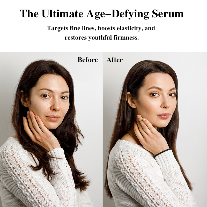 MOSEA ELEMENTS Snail Collagen Boosting Serum | Deep Nourishment & Repair | 30ml | Boost Skin Elasticity & Radiance